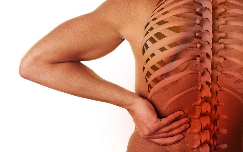 Back pain due to osteochondrosis