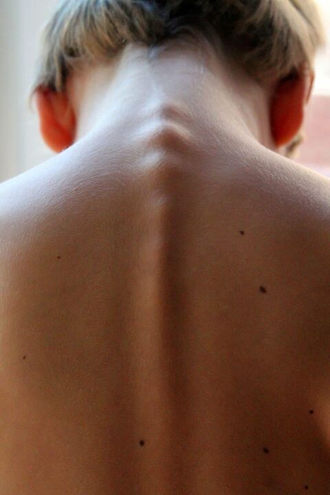 Spine