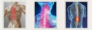 osteochondrosis spinal segments